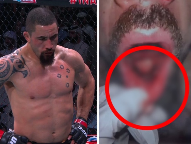 Robert Whittaker suffered a defeat.