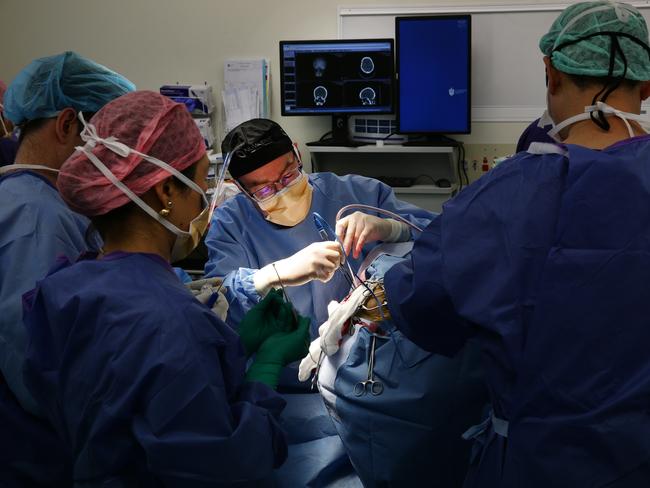 Neurosurgeon Michael Murphy performs a world-first procedure to deliver epilepsy drugs directly to Natalie Kellalea’s brain. Picture: Andrew Tauber