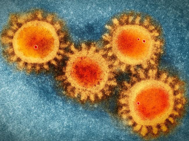 Colored visualisation of electron microscopy photo of the coronavirus  COVID-19