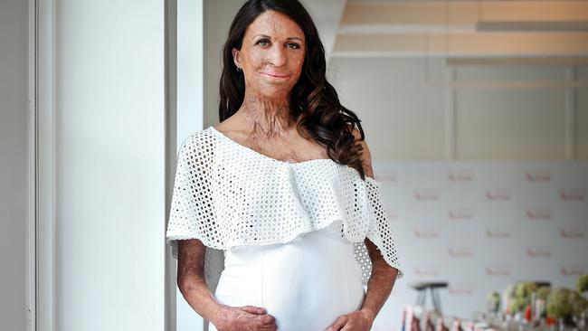 Turia Pitt On Pregnancy ‘ill Get A Baby From The Pain Au