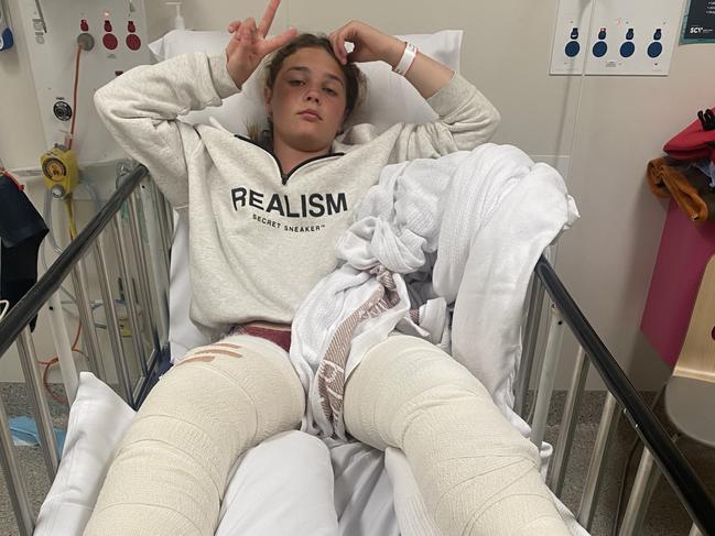 12 year old Sarah Jacka jumped from The Pillars at Mt Martha and broke both her legs.