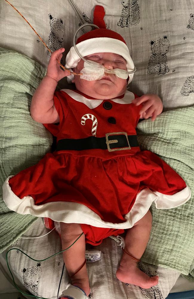 A Christmas ‘miracle’ baby, Moira is the smallest and most premature baby born at Mater Mothers’ Hospital South Brisbane this year. Picture: Supplied