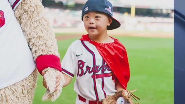 Cooper Murray throws first pitch at Braves game