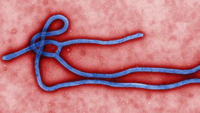 Ebola close-up. This harmless looking squiggle is scaring people the world over. (AP Photo/CDC)