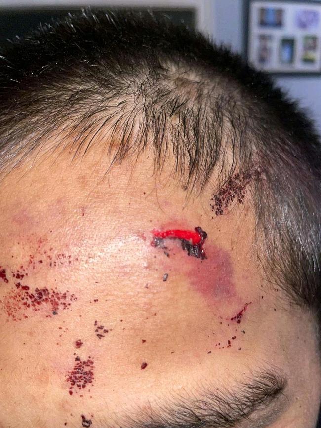 A 15-year-old boy sustained a split head. Picture: supplied