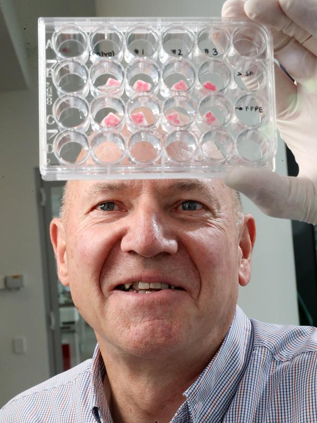 Wayne Tilley has pushed one of the first major advances in breast cancer medications in decades. Picture: Calum Robertson