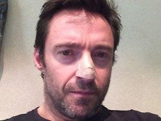 Hugh Jackman