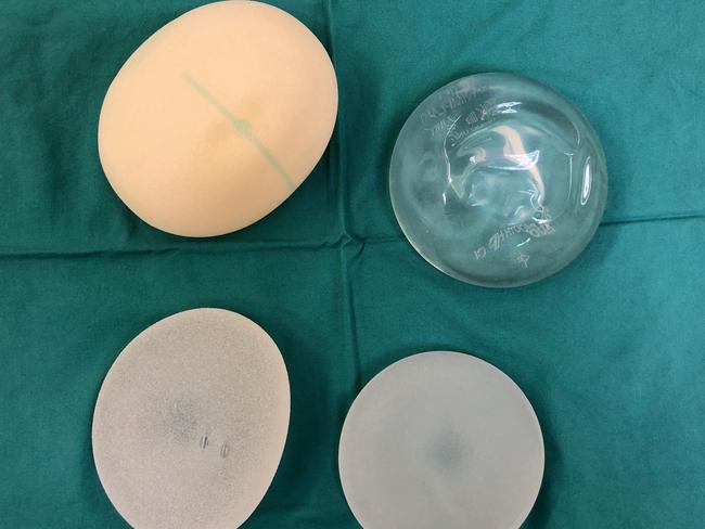 Bacteria around breast implants implicated in cancer. Picture: Supplied