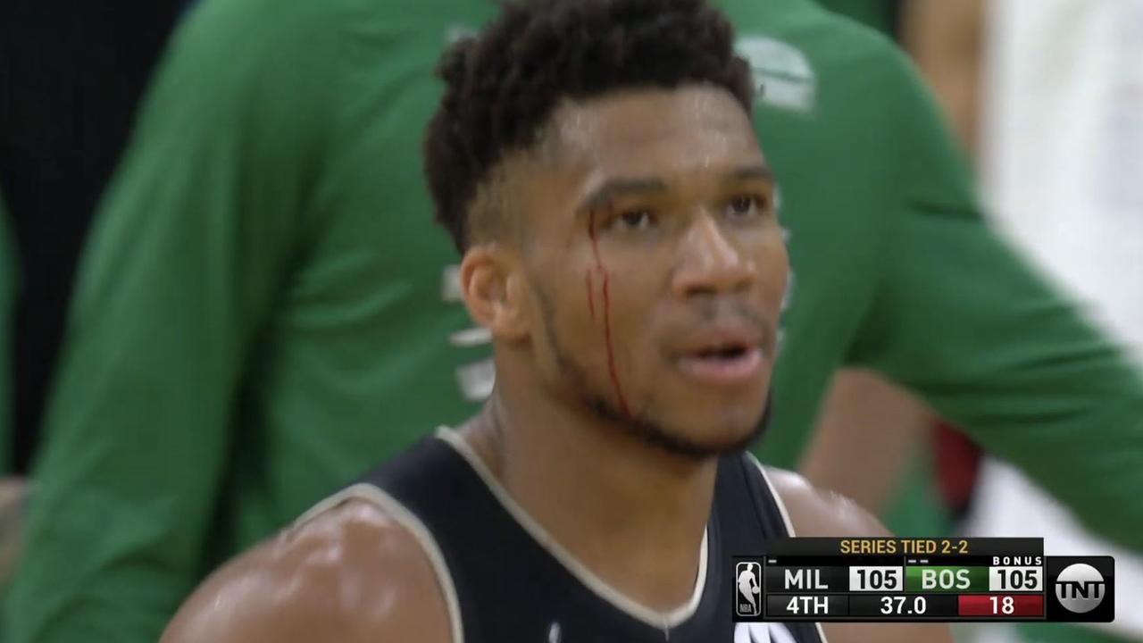 Boston Celtics vs Milwaukee Bucks, skor, Jrue Holiday memblokir Marcus Smart, video, reaksi, mata berdarah Giannis Antetokounmpo