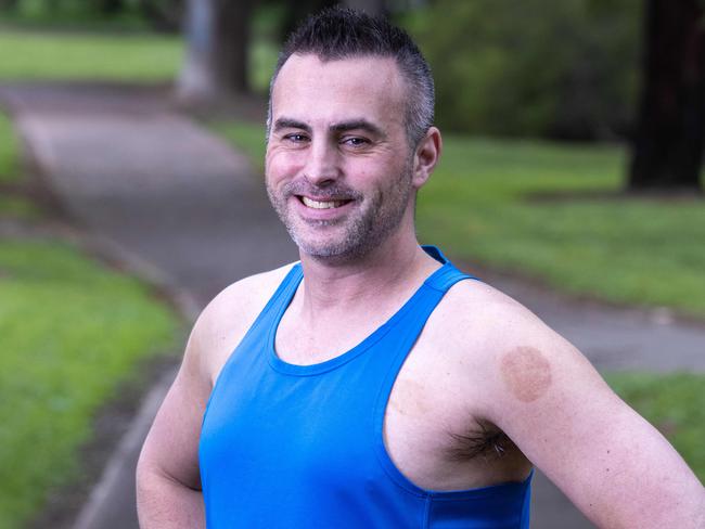 August 25, 2024: Kyle Collis is a 38-year-old cystic fibrosis sufferer about to run his 3rd ultramarathon in light of a new treatment becoming available on the PBS for children aged two years and above in Australia this month.  Picture: Kelly Barnes