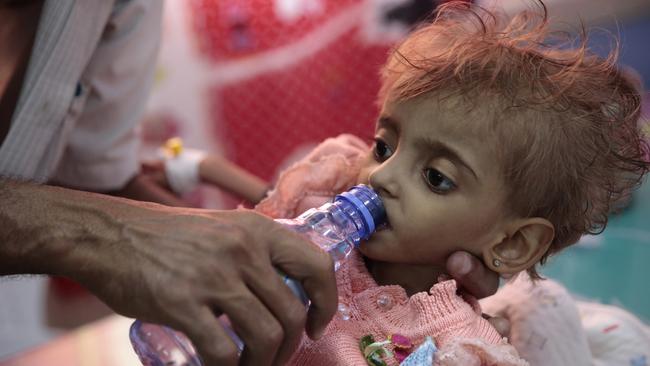 A Yemeni father gives water to his malnourished daughter at a hospital in Hodeida last month. Picture: AP