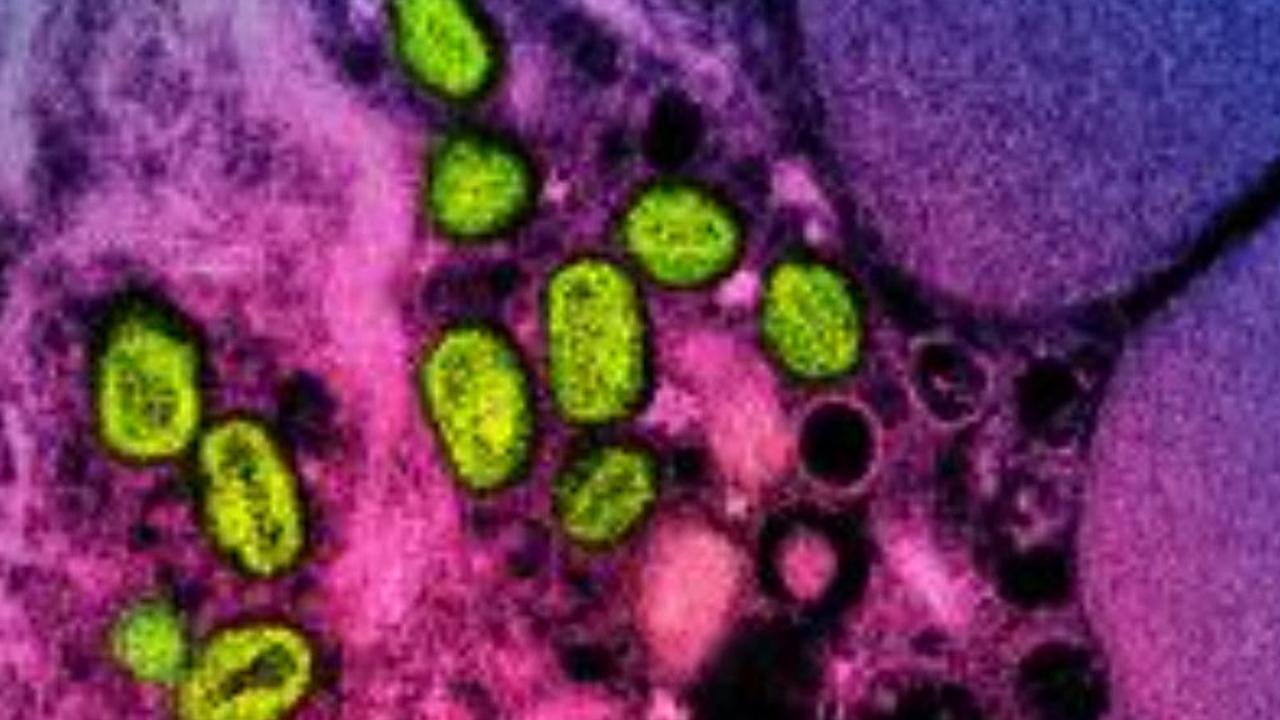 Alarm: ‘Dangerous’ virus spreads past Africa