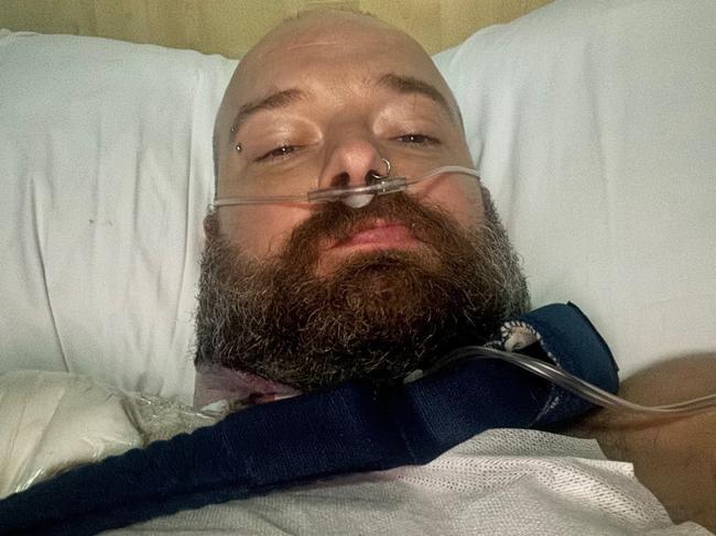 Drouin man Corey Christoph was involved in a motorbike crash on February 15, 2024 after making his way home from Melbourne. Picture: Supplied