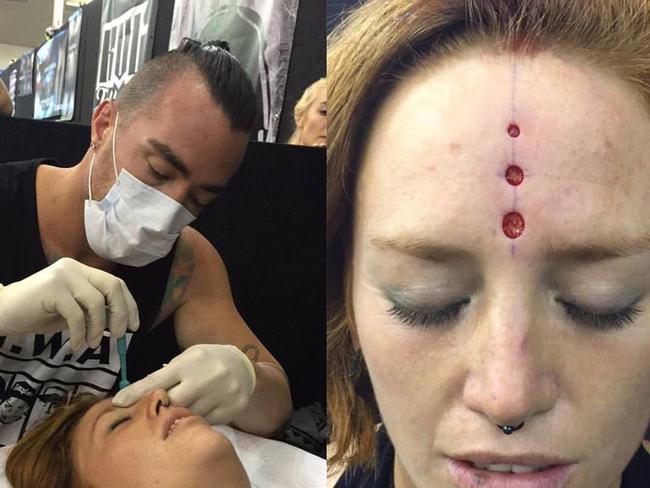 Facebook image of Brendan Russell performing a scarification procedure on a woman at a New Zealand tattoo expo.