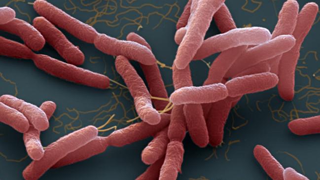 Burkholderia pseudomallei. A bacteria which cause melioidosis, a  disease spread through contaminated water and soil.