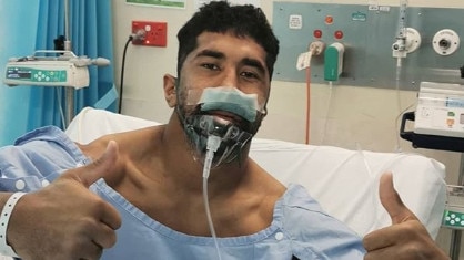 Canberra Raiders star Sia Soliola has had major surgery on his face. Pictures Instagram