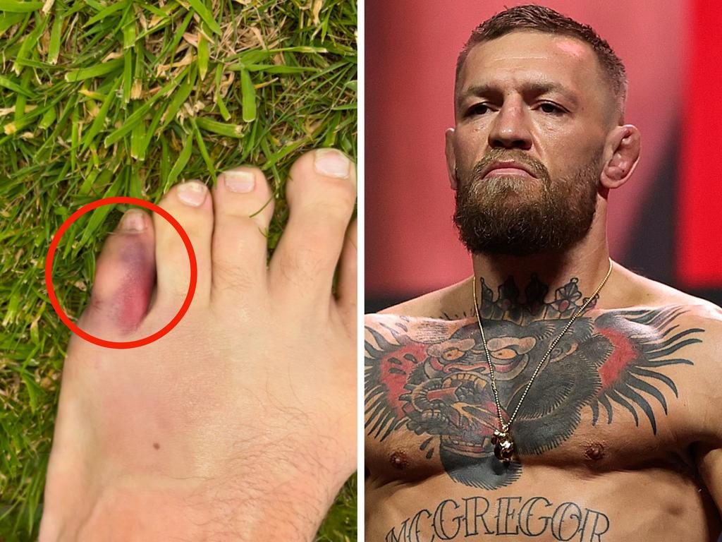 Conor McGregor has revealed the injury that ruled him out of UFC 303. Picture: Getty