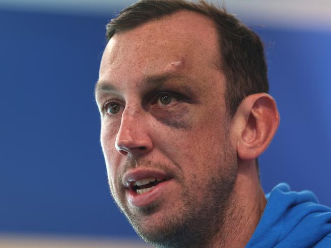 MELBOURNE, AUSTRALIA - APRIL 20: Todd Goldstein of the Kangaroos speaks to the media during a North Melbourne Kangaroos AFL media opportunity at Arden Street Ground on April 20, 2023 in Melbourne, Australia. (Photo by Robert Cianflone/Getty Images)