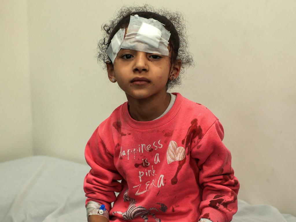 An injured Palestinian girl looks on after receiving treatment at the Kuwait hospital following Israeli bombardment in Rafah, in the southern Gaza Strip on December 14. Picture: SAID KHATIB / AFP