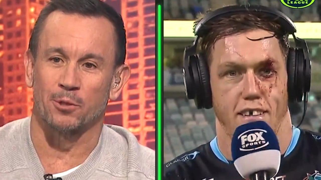 Disfigured Nrl Weapon Too Grotesque For Matty Johns Show 