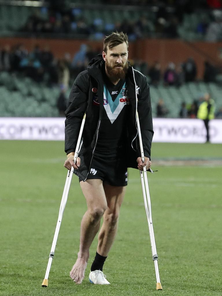 Dixon said his road to recovery from a broken leg in 2018 led down a dark path. Picture: Sarah Reed