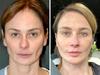 ‘I got plastic surgery to fix my frown’