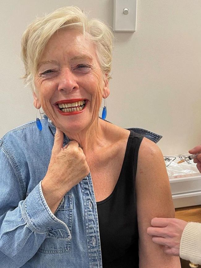 Foodie Maggie Beer bares her arm.