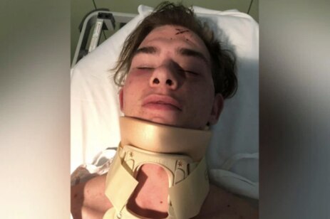 Jayden D'Abaco was hospitalised after the gang ambush in Werribee.