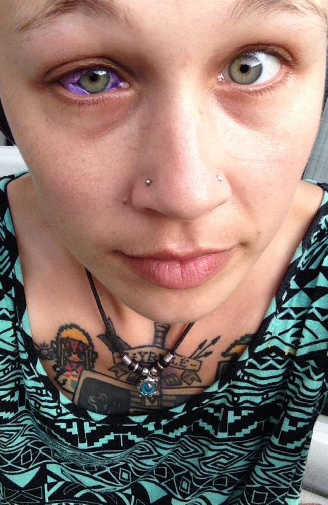 Catt Gallinger eye tattoo gone wrong. Picture: Facebook