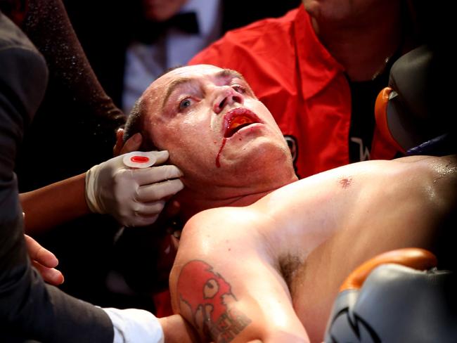How does a knockout happen?   — Australia's leading