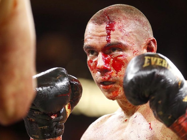 Tim Tszyu was busted open badly early in his bout with Sebastian Fundora in Las Vegas. Picture: Getty Images