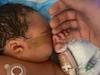 ‘We would do anything to save him’: Tiny baby’s fight for life