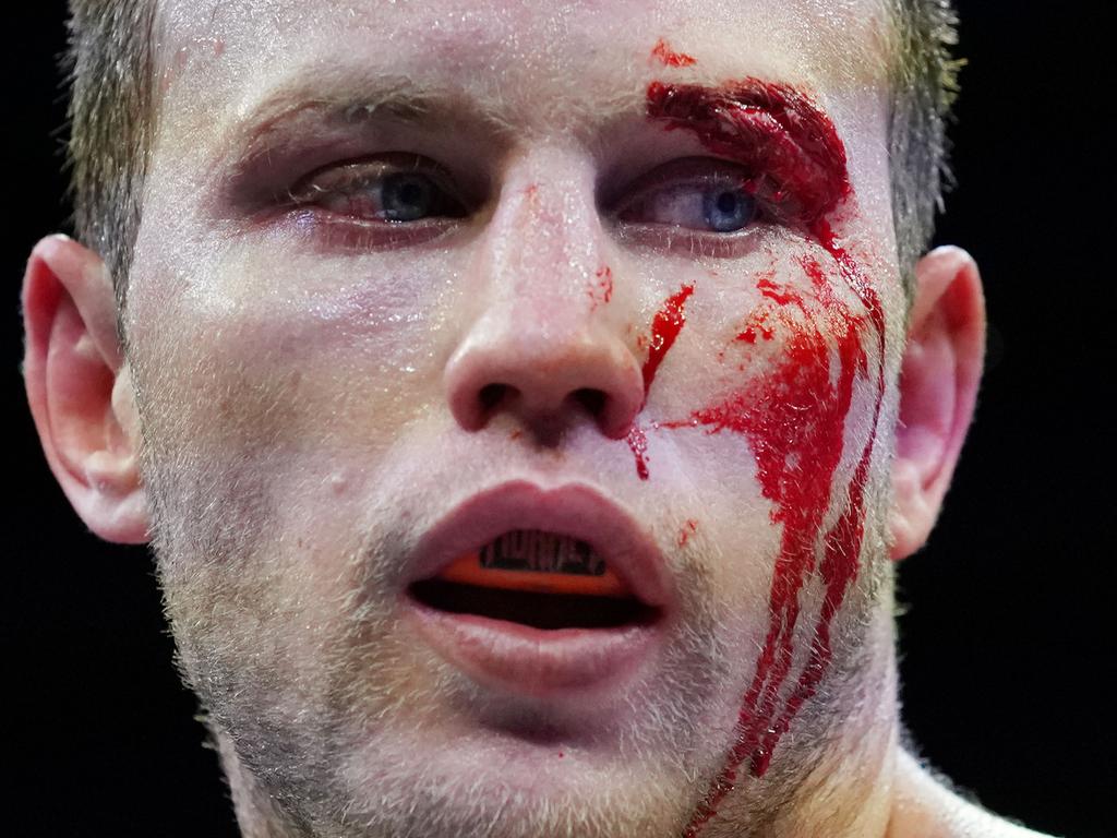 Jeff Horn was left battered and bloodied by Michael Zerafa.