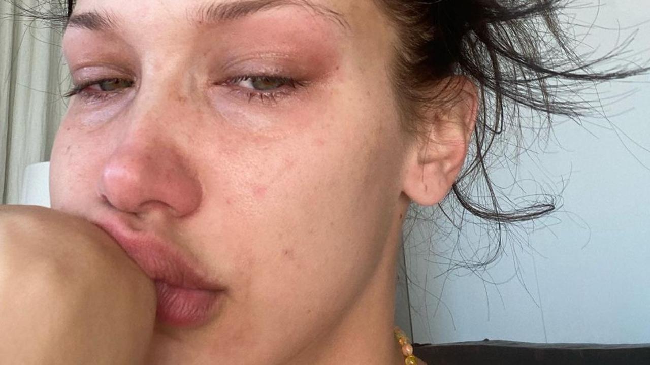 Bella Hadid opens up about her history of abusive relationships