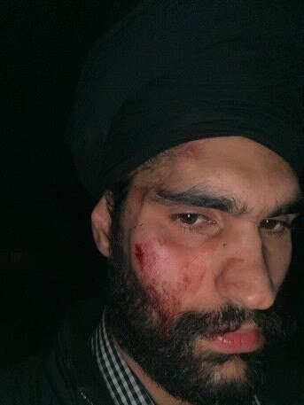 Jaspreet was taken to the Lyell McEwin hospital with facial injuries. Picture: Supplied