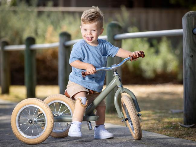 McKenzie Stanforth, 2, was born with Fibular Hemimelia, had his foot amputated and now has a prosthetic foot. Mother Cassie. Picture: Mark Stewart