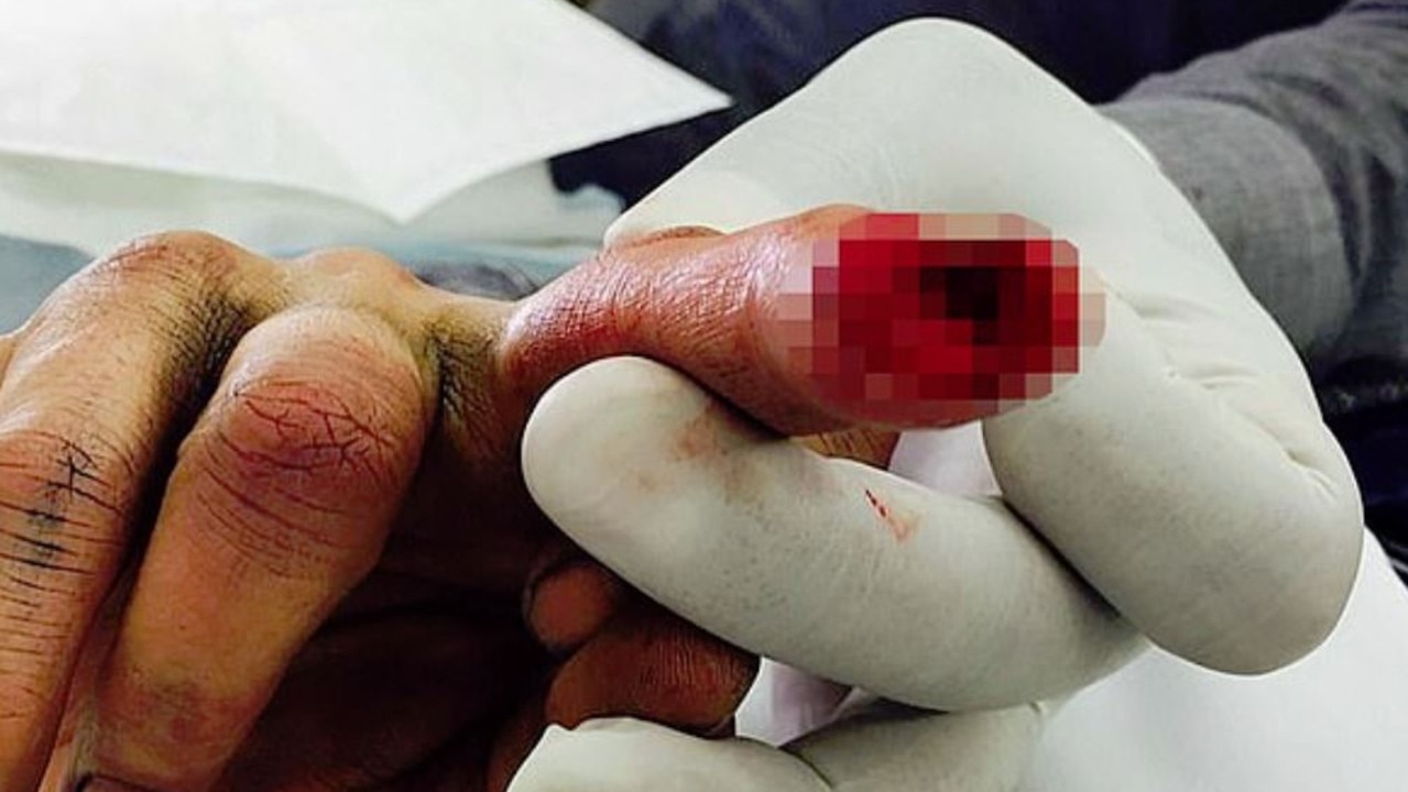 Johnny Depp claimed his finger injury was a result of Heard’s violent outburst. Picture: Supplied.