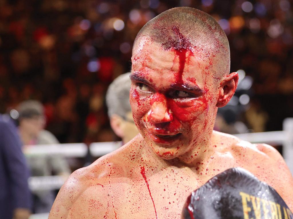 Tim Tszyu was cut badly in his loss to Sebastian Fundora. Picture: Getty Images via AFP