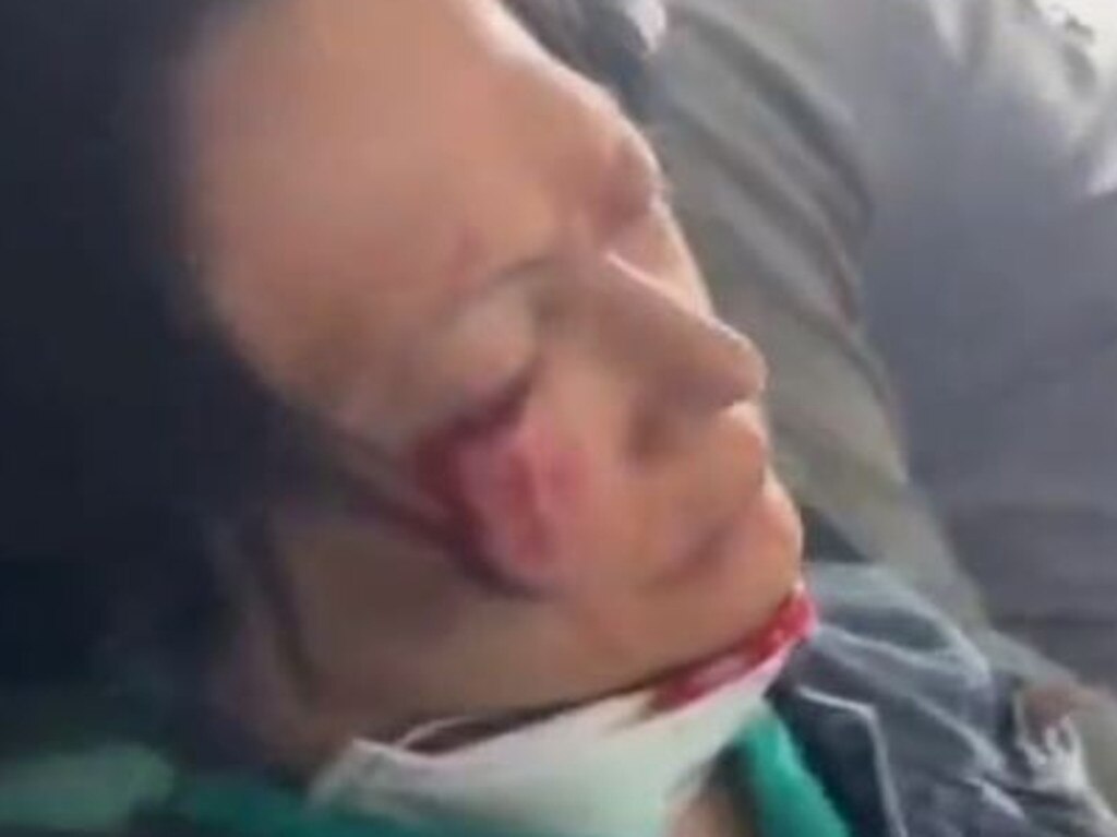 A bloody gash on a passenger’s face. Picture: Twitter