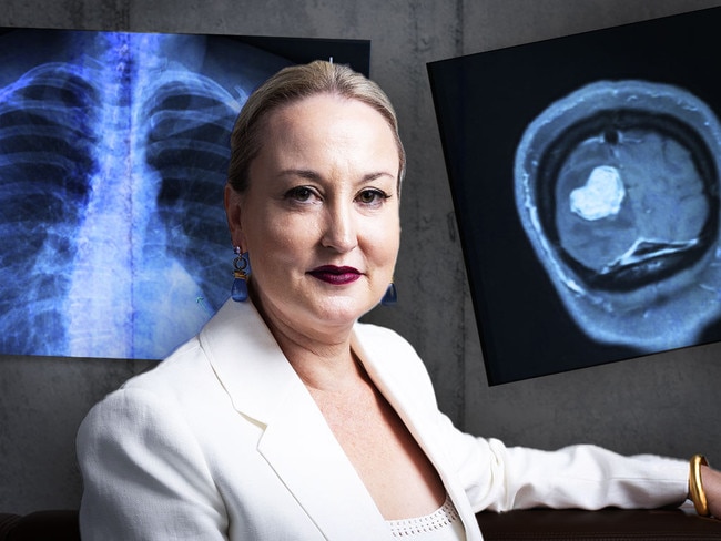 Margaret Lawson has been diagnosed with stage four lung cancer, despite never having smoked.