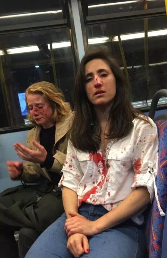 Melania Geymonat (right) and her girlfriend Chris (left) were horrifically attacked when they refused to kiss for a gang of thugs’ entertainment on a London bus last week.