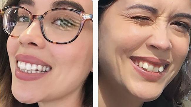 An after and before comparison from SmileDirectClub's website. Picture: SmileDirectClub