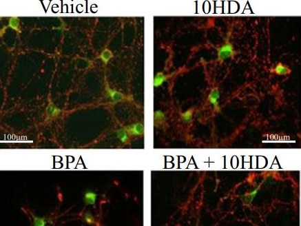 Research finds between prenatal exposure to plastics and autism in boys. Picture: Nature Communications