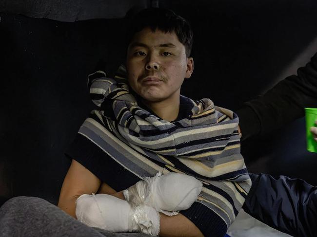 An alleged soldier presented as North Korean detained by Ukrainian authorities at an undisclosed location in Ukraine, following his capture by the Ukrainian army. Ukraine said on January 11, 2025 that investigators were questioning two wounded North Korean soldiers after they were captured in Russia's Kursk region, saying they provided ‘indisputable evidence’ that North Koreans were fighting for Moscow. (Photo by Handout / Telegram/V_Zelenskiy_official / AFP)