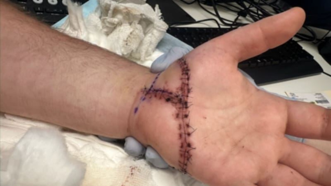 NDIS machete attack: ‘I thought I was going to die’