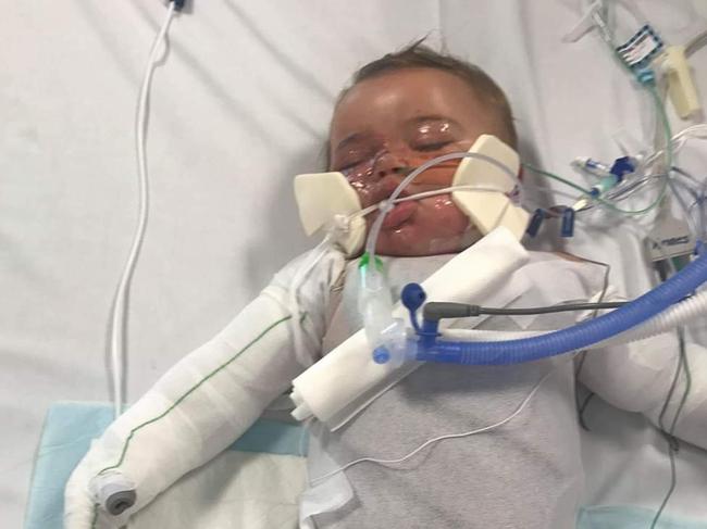 Braylen Macnamara spent 16 days in the paediatric intensive care unit.