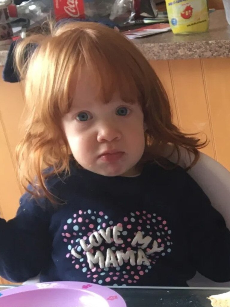 The toddler before shot got into the hair removal cream. Picture: Kennedy News