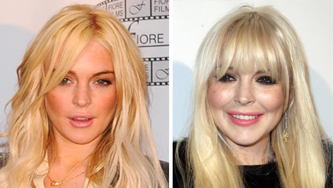 Lindsay Lohan Appears To Have A New Face Thanks To Plastic Surgery News Com Au Australias