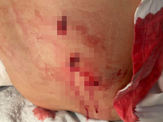 The woman suffered three stab wounds in her back and now has ‘obvious scars’, she told the court through a victim impact statement. Picture: Supplied.
