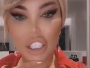 ‘Ken Doll’s new chin goes horribly wrong